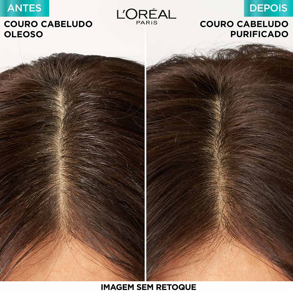 L'Oréal Paris Elseve Pure Hialurônico Shampoo Purificante